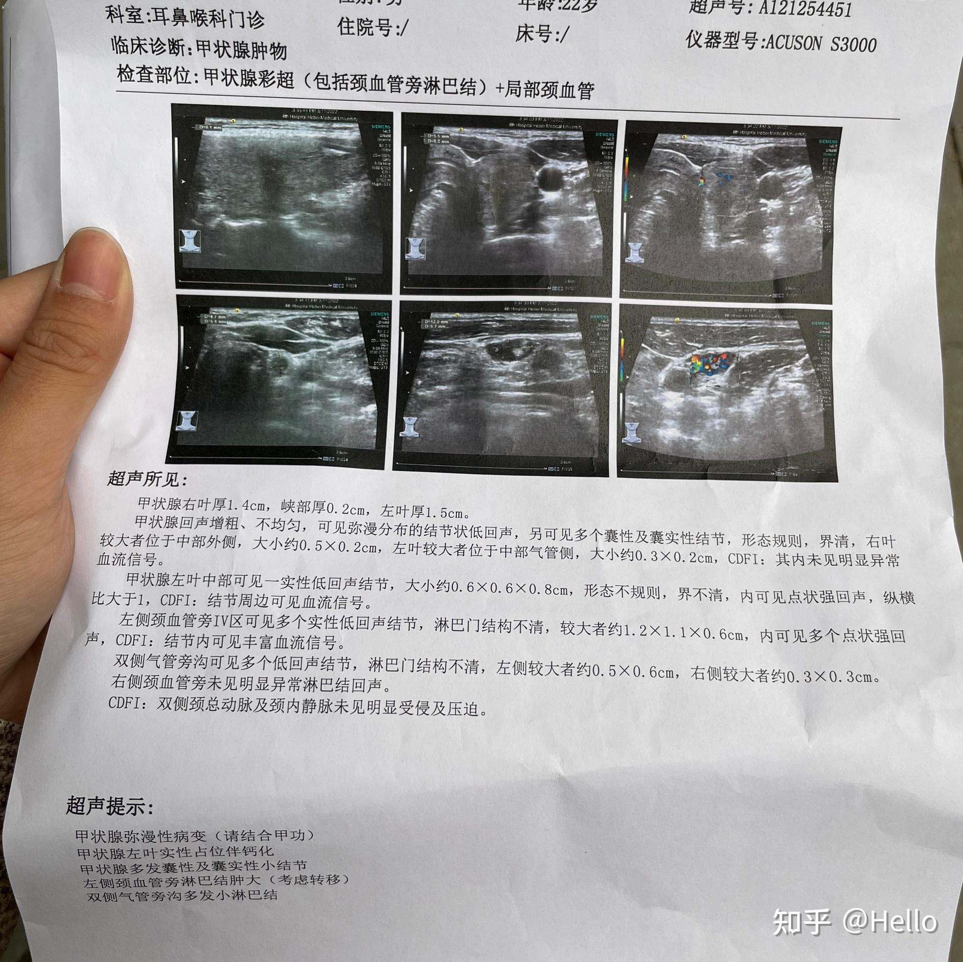 深入了解，131检查的全过程解析，全面解析，深入了解131检查的全过程